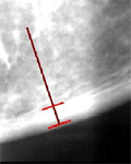 panoramic radiograph